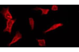ABIN6276122 staining COLO205 by IF/ICC. (OR1B1 antibody  (Internal Region))