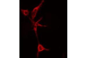 ABIN6274808 staining COLO205 cells by IF/ICC. (LYPLA1 antibody  (Internal Region))