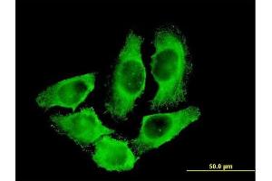 Immunofluorescence of monoclonal antibody to CKM on HeLa cell. (CKM antibody  (AA 282-381))