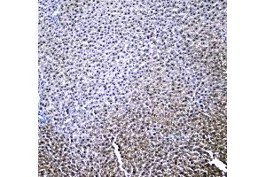 IHC analysis of RXRA using anti-RXRA antibody . (Retinoid X Receptor alpha antibody  (AA 226-462))