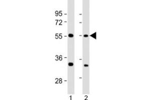 Western blot testing of human 1) 293T/17 and 2) HeLa cell lysate with AAAS antibody at 1:2000. (Adracalin antibody  (AA 395-425))