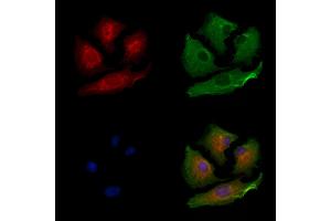 ABIN6264206 and ABIN6279656 staining  cells by IF/ICC. (PIGP antibody  (Internal Region))