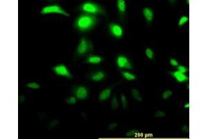 Image no. 2 for anti-Chloride Intracellular Channel 3 (CLIC3) (AA 137-237) antibody (ABIN465974) (CLIC3 antibody  (AA 137-237))