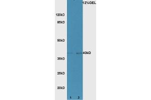 Lane 1:mouse skin lysates Lane 2:mouse heart lysates probed with Rabbit Anti-DBPA/CSDA1 Polyclonal Antibody, Unconjugated (ABIN1714724) at 1:300 overnight at 4 °C. (CSDA antibody  (AA 165-270))