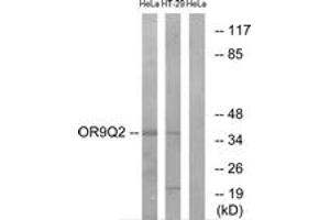 Western blot analysis of extracts from HeLa/HT-29 cells, using OR9Q2 Antibody. (OR9Q2 antibody  (AA 232-281))