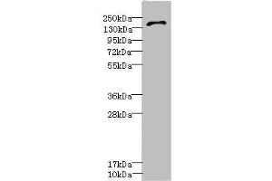 Western blot All lanes: GRIN2D antibody IgG at 3. (GRIN2D antibody  (AA 330-480))