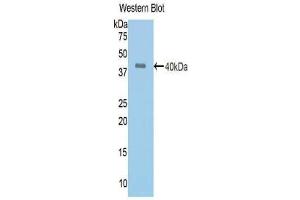 Western blot analysis of the recombinant protein. (Angiotensin I Converting Enzyme 1 antibody  (AA 504-597))