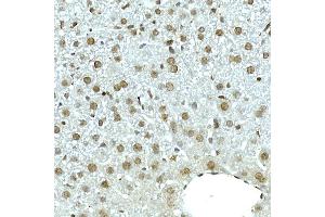 Immunohistochemistry of paraffin-embedded mouse liver using NOP10 Rabbit mAb (ABIN7268953) at dilution of 1:50 (40x lens). (Nop10 antibody)