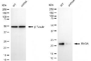 Western blotting analysis using RHOA antibody (ABIN7800142).