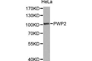 Western Blotting (WB) image for anti-PWP2 (Periodic Tryptophan Protein) Homolog (PWP2H) antibody (ABIN1876958) (PWP2 antibody)
