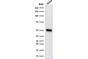 Western Blotting (WB) image for anti-Forkhead Box A1 (FOXA1) (AA 372-472) antibody (ABIN6939655)