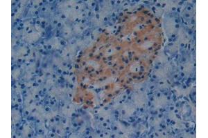 IHC-P analysis of Mouse Pancreas Tissue, with DAB staining. (PAI1 antibody  (AA 141-389))