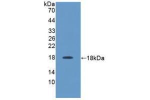 Western blot analysis of recombinant Rat IL17. (IL-17 antibody  (AA 18-150))