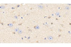 Detection of PRDX6 in Bovine Cerebrum Tissue using Polyclonal Antibody to Peroxiredoxin 6 (PRDX6) (Peroxiredoxin 6 antibody  (AA 1-224))