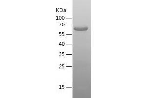 Western Blotting (WB) image for Papillary Renal Cell Carcinoma (Translocation-Associated) (PRCC) (AA 215-491) protein (His-IF2DI Tag) (ABIN7283785) (PRCC Protein (AA 215-491) (His-IF2DI Tag))