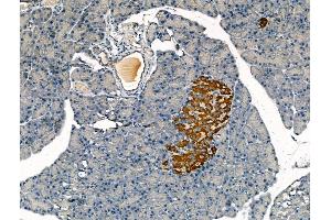 Clathrin heavy chain Antibody at 1/100 staining Rat pancreatic tissue by IHC-P.