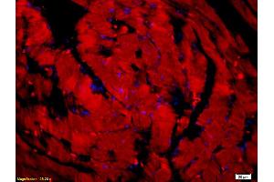 Formalin-fixed and paraffin embedded mouse heart tissue labeled with Anti-LSP1 Polyclonal Antibody, unconjugated (ABIN755632) at 1: 200 followed by incubation with conjugated secondary antibody (Goat Anti-Rabbit IgG, Cy3 conjugated   used at 1: 200 dilution for 40 minutes at 37°C and DAPI staining). (LSP1 antibody  (AA 241-339))