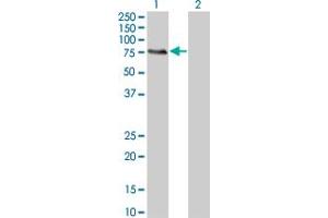 Western Blot analysis of MGRN1 expression in transfected 293T cell line by MGRN1 monoclonal antibody (M07), clone 3E1. (Mahogunin RING Finger Protein 1 antibody  (AA 477-576))