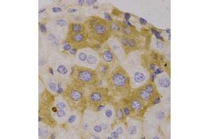 Immunohistochemistry of paraffin-embedded human liver, using NBR1 antibody (ABIN5972123).