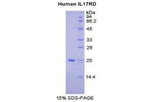 SDS-PAGE (SDS) image for Interleukin 17 Receptor D (IL17RD) (AA 157-299) protein (His tag) (ABIN2121421)