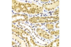 Immunohistochemistry (Paraffin-embedded Sections) (IHC (p)) image for anti-ELAV (Embryonic Lethal, Abnormal Vision, Drosophila)-Like 1 (Hu Antigen R) (ELAVL1) (AA 1-326) antibody (ABIN3022231)