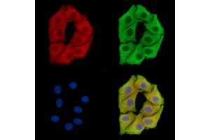 ABIN7096440 and ABIN7100504 staining Hela cells by IF/ICC.