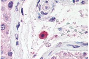 anti-Tumor Necrosis Factor Receptor Superfamily, Member 13B (TNFRSF13B) (N-Term) antibody