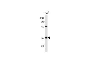 Western blot analysis of lysate from Raji cell line,using ACOT8 Antibody (ABIN6241571). (ACOT8 antibody)