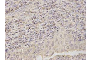 Immunohistochemistry (IHC) image for anti-Ribosomal Protein, Large, P0 (RPLP0) antibody (ABIN1876737) (RPLP0 antibody)