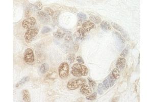 Immunohistochemistry (IHC) image for anti-CCR4-NOT Transcription Complex, Subunit 2 (CNOT2) (AA 490-540) antibody (ABIN7448479)