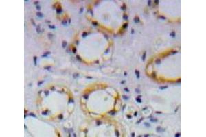Used in DAB staining on fromalin fixed paraffin-embedded Kidney tissue (APP antibody  (AA 672-711))