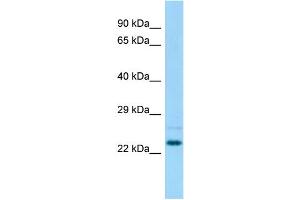 Host: Rabbit Target Name: Nsg1 Sample Type: Rat Testis lysates Antibody Dilution: 1.