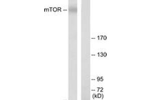 Western blot analysis of extracts from K562 cells, using mTOR (Ab-2448) Antibody. (MTOR antibody  (AA 2415-2464))