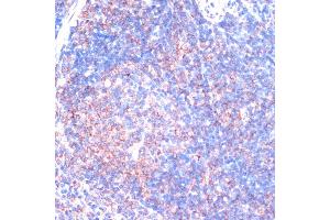 Immunohistochemistry of paraffin-embedded mouse spleen using RPS6K antibody (ABIN7270037) at dilution of 1:100 (40x lens).