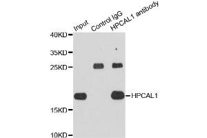 Immunoprecipitation analysis of extracts of HepG2 cells using HPCAL1 antibody (ABIN6003726). (HPCAL1 antibody)