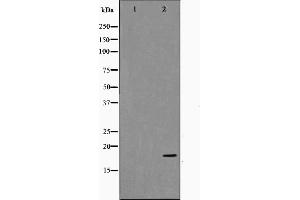 Western blot analysis on HuvEc cell lysate using TP53I11 Antibody. (TP53I11 antibody  (N-Term))