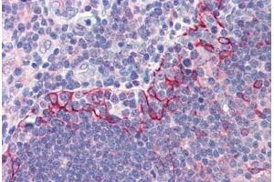 Human Thymus (formalin-fixed, paraffin-embedded) stained with TLR6 antibody ABIN214529 at 5 ug/ml followed by biotinylated goat anti-rabbit IgG secondary antibody ABIN481713, alkaline phosphatase-streptavidin and chromogen. (TLR6 antibody  (Internal Region))