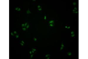 Immunofluorescence staining of Hela cells with ABIN7148805 at 1:100, counter-stained with DAPI. (ATF6 antibody  (AA 1-194))