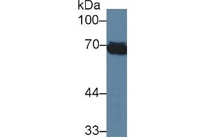 Western blot analysis of Human Raji cell lysate, using Human HSPA1L Antibody (3 µg/ml) and HRP-conjugated Goat Anti-Mouse antibody ( (TPSAB1 antibody  (AA 161-262))