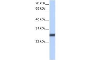 Western Blotting (WB) image for anti-Transmembrane Protease, serine 5 (TMPRSS5) antibody (ABIN2463308) (TMPRSS5 antibody)