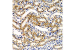 Immunohistochemistry of paraffin-embedded mouse kidney using ZF antibody (ABIN6130814, ABIN6150426, ABIN6150427 and ABIN6223369) at dilution of 1:100 (40x lens). (ZFAND3 antibody  (AA 1-227))