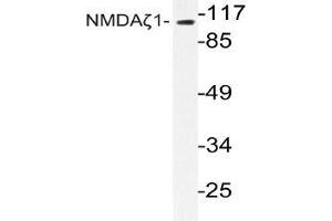 Western blot (WB) analyzes of NMDAzeta1 antibody in extracts from Jurkat cells.