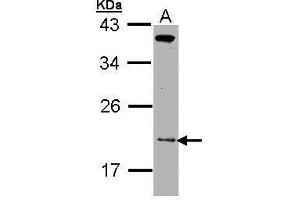 WB Image Sample (30 ug of whole cell lysate) A: Molt-4 , 12% SDS PAGE antibody diluted at 1:1000 (ZNHIT1 antibody)