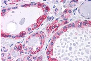 Human Thyroid: Formalin-Fixed, Paraffin-Embedded (FFPE)
