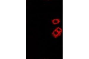 Immunofluorescent analysis of Tryptase alpha/beta staining in Hela cells. (TPSAB1 antibody)
