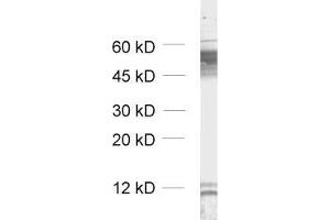 dilution: 1 : 1000, sample: unboiled synaptic membrane fraction of rat brain (LP1) (GABRB2 antibody  (AA 343-430))