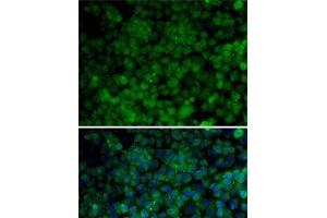 Immunofluorescence analysis of HeLa cells using CDK7 Polyclonal Antibody (CDK7 antibody)