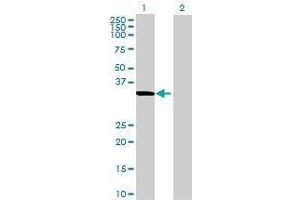 Lane 1: RPUSD3 transfected lysate ( 37. (RPUSD3 293T Cell Transient Overexpression Lysate(Denatured))