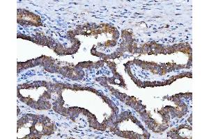 IHC analysis of HSD17B7 using anti-HSD17B7 antibody (ABIN7600174). (HSD17B7 antibody  (AA 16-336))