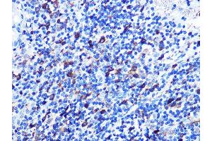 Immunohistochemistry of paraffin-embedded human appendix using Stathmin 1 Rabbit mAb (ABIN1678518, ABIN3018873, ABIN3018874 and ABIN7101680) at dilution of 1:100 (40x lens). (Stathmin 1 antibody)